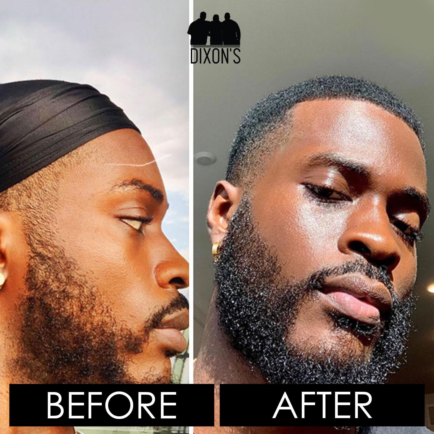 Beard Butter, Beard Care with Moisturizing Balm, Patches Filling Dry Beard Solution, Paraben, Sulfate, and Petroleum-Free for Natural Grooming Bliss, (2Oz)